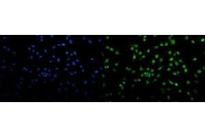IF analysis of Transketolase/TKT using anti-Transketolase/TKT antibody (ABIN7598957). (TKT antibody  (AA 1-116))