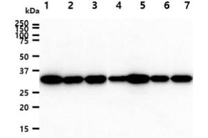 The cell lysates (40ug) were resolved by SDS-PAGE, transferred to PVDF membrane and probed with anti-human PPIE antibody (1:1000). (PPIE antibody)