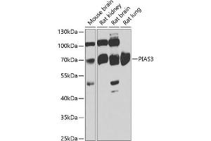 Western blot analysis of extracts of various cell lines, using PI antibody (ABIN6128452, ABIN6145599, ABIN6145601 and ABIN6222851) at 1:1000 dilution. (PIAS3 antibody  (AA 452-628))