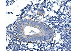 IHC analysis of SYP using anti-SYP antibody (ABIN7603120).