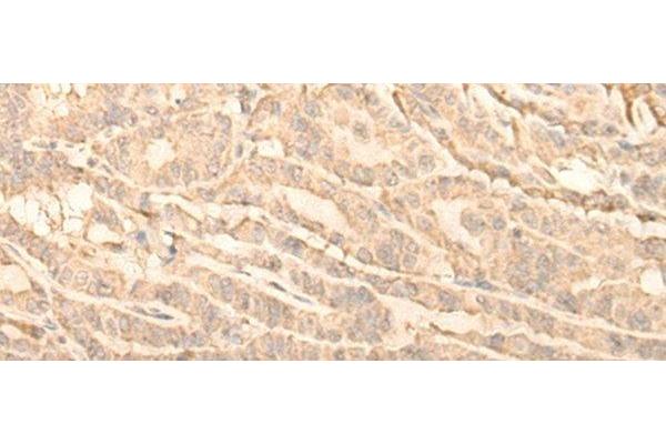 RNF146 antibody