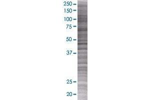 CETN2 transfected lysate. (CETN2 293T Cell Transient Overexpression Lysate(Denatured))