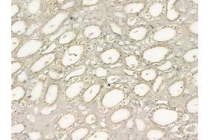 ABIN6262920 and ABIN6277730 at 1/100 staining human normal kidney tissue by IHC-P. (LATS1,2 (Internal Region) antibody)