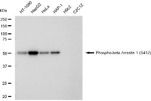 Western blotting analysis using Phospho-beta Arrestin 1 (S412) antibody (ABIN7797654).
