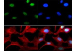 Immunocytochemistry of Rabbit Anti-Histone H3 [Monomethyl Lys4] Antibody.