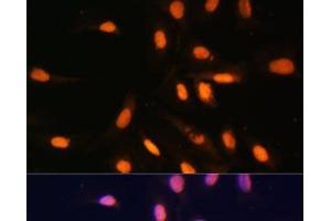 Immunofluorescence analysis of U-2 OS cells using MonoMethyl-Histone H3-K4 Polyclonal Antibody at dilution of 1:100. (Histone 3 antibody  (meLys4))