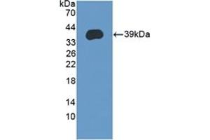 Detection of Recombinant LEAP2, Human using Polyclonal Antibody to Liver Expressed Antimicrobial Peptide 2 (LEAP2) (LEAP2 antibody  (AA 23-76))