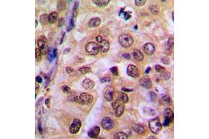 Immunohistochemistry (IHC) image for anti-Inhibitor of kappa Light Polypeptide Gene Enhancer in B-Cells, Kinase gamma (IKBKG) (Center) antibody (ABIN7297398)