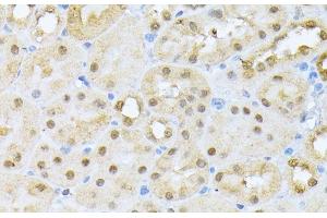 Immunohistochemistry of paraffin-embedded Mouse kidney using CSNK2A1 Polyclonal Antibody at dilution of 1:100 (40x lens). (CSNK2A1/CK II alpha antibody)