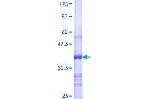 SET Binding Factor 2 (SBF2) (AA 1-100) protein (GST tag)