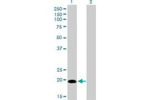 Western Blot analysis of CETN1 expression in transfected 293T cell line by CETN1 monoclonal antibody (M01), clone 2A6. (Centrin 1 antibody  (AA 1-100))
