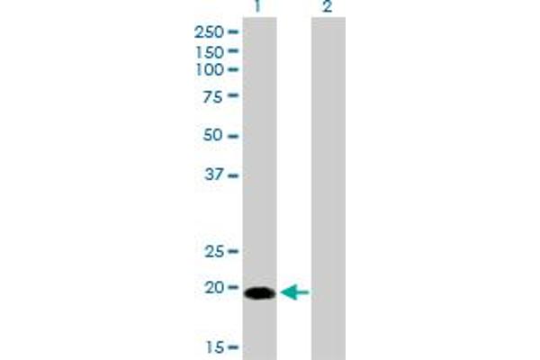 Centrin 1 Antikörper  (AA 1-100)
