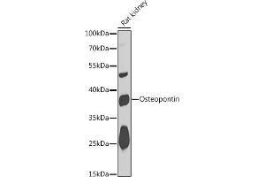 Western blot analysis of extracts of Rat kidney, using Osteopontin antibody (ABIN6132294, ABIN6148378, ABIN6148380 and ABIN6218573) at 1:1000 dilution. (Osteopontin antibody  (AA 106-205))