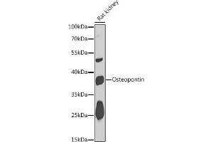 Western blot analysis of extracts of Rat kidney, using Osteopontin antibody (ABIN6132294, ABIN6148378, ABIN6148380 and ABIN6218573) at 1:1000 dilution. (Osteopontin antibody  (AA 106-205))