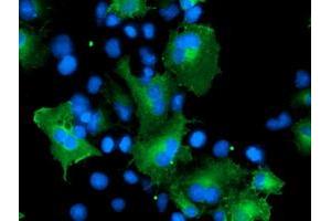 Immunofluorescence (IF) image for anti-Cerebral Cavernous Malformation 2 (CCM2) antibody (ABIN1497136) (CCM2 antibody)