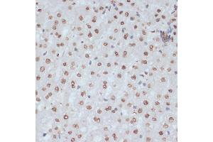 Immunohistochemistry of paraffin-embedded rat liver using Phospho-CDK1-Y15 antibody (ABIN3019442, ABIN3019443, ABIN3019444 and ABIN6225371) at dilution of 1:100 (40x lens). (CDK1 antibody  (pTyr15))