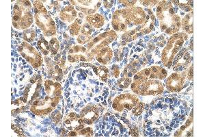 Enolase 3 antibody was used for immunohistochemistry at a concentration of 4-8 ug/ml. (ENO3 antibody)