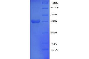 Ubiquinol-Cytochrome C Reductase, Complex III Subunit VII, 9. (UQCRQ Protein (AA 2-78, partial) (GST tag))