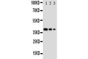 Lane 3: Recombinant Human GATA2 Protein 2. (GATA2 antibody  (N-Term))