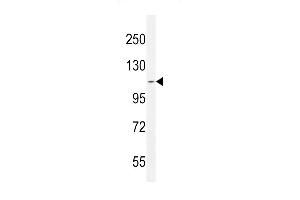 AT8B2 Antibody (N-term) (ABIN654734 and ABIN2844422) western blot analysis in CEM cell line lysates (35 μg/lane). (ATP8B2 antibody  (N-Term))