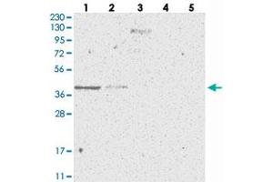 Western blot analysis of Lane 1: RT-4, Lane 2: U-251 MG, Lane 3: Human Plasma, Lane 4: Liver, Lane 5: Tonsil with SLC35A5 polyclonal antibody . (SLC35A5 antibody)