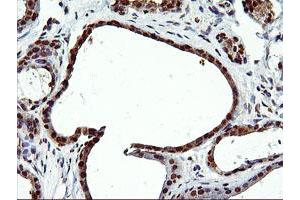 Immunohistochemistry (IHC) image for anti-EPM2A (Laforin) Interacting Protein 1 (EPM2AIP1) antibody (ABIN1498046) (EPM2AIP1 antibody)