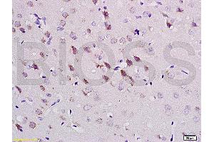 Formalin-fixed and paraffin embedded rat brain tissue labeled with Anti-CaMK2a Polyclonal Antibody (ABIN670176), Unconjugatedat 1:200, followed by conjugation to the secondary antibody and DAB staining (CAMK2A antibody  (AA 401-478))