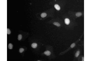 Immunofluorescent staining of A549 (ATCC CCL-185) cells. (Retinoblastoma 1 antibody  (AA 332-344))