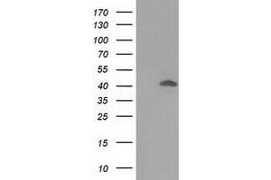 HEK293T cells were transfected with the pCMV6-ENTRY control (Left lane) or pCMV6-ENTRY DNAJB1 (Right lane) cDNA for 48 hrs and lysed. (DNAJB1 antibody)