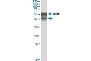 Immunoprecipitation of BCAT2 transfected lysate using anti-BCAT2 MaxPab rabbit polyclonal antibody and Protein A Magnetic Bead , and immunoblotted with BCAT2 MaxPab rabbit polyclonal antibody (D01) . (BCAT2 antibody  (AA 1-392))