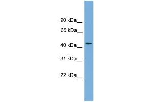 WB Suggested Anti-ZNF620 Antibody Titration: 0. (ZNF620 antibody  (N-Term))