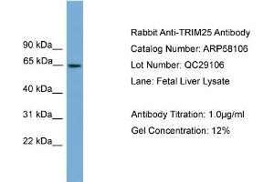 WB Suggested Anti-TRIM25  Antibody Titration: 0. (TRIM25 antibody  (Middle Region))