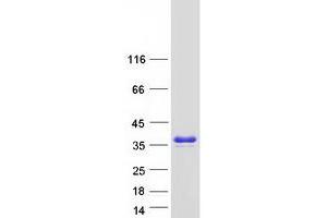 Validation with Western Blot