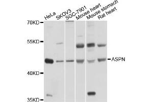 Western blot analysis of extracts of various cell lines, using ASPN antibody (ABIN5997270) at 1/1000 dilution. (Asporin antibody)