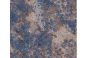 Figure. (TRADD antibody  (AA 24-261))