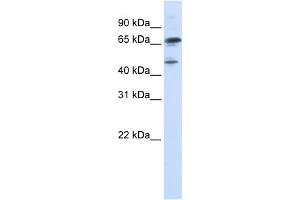 WB Suggested Anti-FOXP4 Antibody Titration:  0.