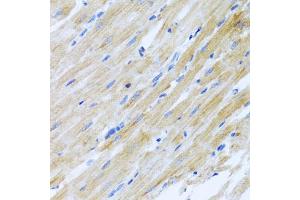 Immunohistochemistry of paraffin-embedded rat heart using CCL17 antibody (ABIN5971483) at dilution of 1/100 (40x lens). (CCL17 antibody)