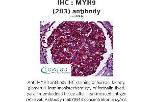 Image no. 1 for anti-Myosin 9 (MYH9) antibody (ABIN1723793) (Myosin 9 antibody)