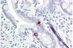 Image no. 1 for anti-Neurotrimin (NTM) (AA 91-140) antibody (ABIN6749729) (Neurotrimin antibody  (AA 91-140))