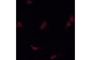 ABIN6276807 staining HepG2? (KNG1 antibody  (N-Term))