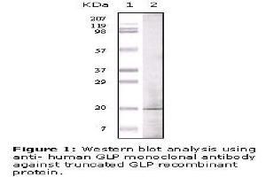 Image no. 1 for anti-Golgin A6 Family, Member A (GOLGA6A) antibody (ABIN207616) (GOLGA6A antibody)
