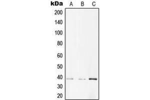Western blot analysis of AMPK beta 1 (pS182) expression in A431 (A), NIH3T3 (B), PC12 (C) whole cell lysates. (PRKAB1 antibody  (pSer182))