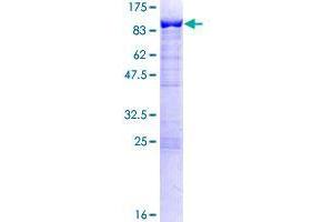 Image no. 1 for SWAP Switching B-Cell Complex 70kDa Subunit (SWAP70) (AA 1-585) protein (GST tag) (ABIN1321955)