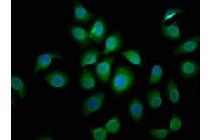 Immunofluorescence staining of A549 cells with ABIN7145298 at 1:50, counter-stained with DAPI. (BCL2L1 antibody  (AA 19-127))