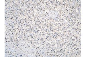 IHC analysis of CCDC36 using anti-CCDC36 antibody (ABIN6719645). (CCDC36 antibody  (AA 172-472))