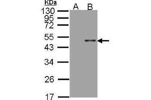 WB Image Western Blot analysis of ARSB expression in transfected 293T cell line by ARSB polyclonal antibody. (Arylsulfatase B antibody)