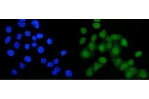 IF analysis of B MyB/MYBL2 using anti-B MyB/MYBL2 antibody (ABIN7601277). (MYBL2 antibody  (AA 31-695))