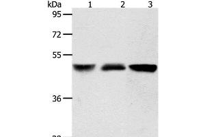 Western Blot analysis of Human brain malignant glioma and Human fetal kidney tissue, A172 cell using ACOT9 Polyclonal Antibody at dilution of 1:600