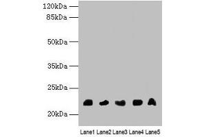Western blot All lanes: NRSN1 antibody at 3 μg/mL Lane 1: Mouse stomach tissue Lane 2: Mouse kidney tissue Lane 3: Mouse thymus tissue Lane 4: Hela whole cell lysate Lane 5: 293T whole cell lysate Secondary Goat polyclonal to rabbit IgG at 1/10000 dilution Predicted band size: 22 kDa Observed band size: 22 kDa (Neurensin 1 antibody  (AA 1-65))