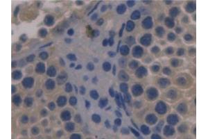 Detection of FBLN1 in Mouse Testis Tissue using Monoclonal Antibody to Fibulin 1 (FBLN1) (Fibulin 1 antibody  (AA 399-578))